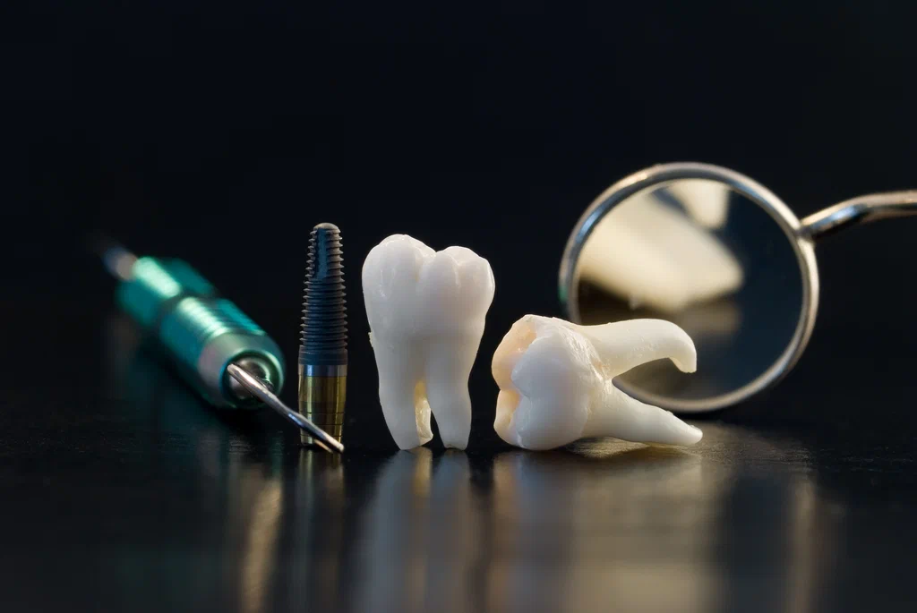 full set of teeth implants in turkey