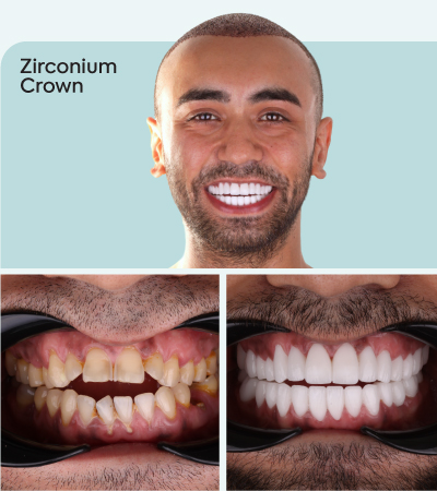 mcan dental before and after photos 