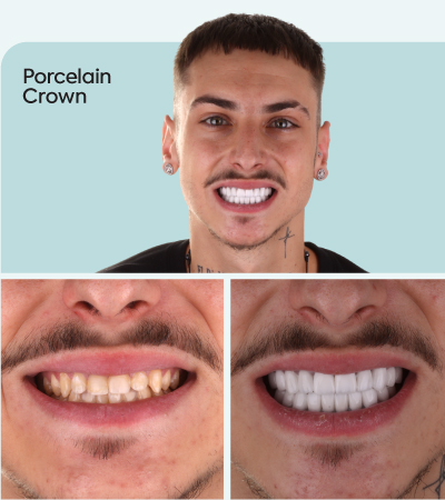 mcan dental before and after 2