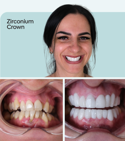 mcan dental before and after 3